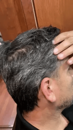 Shampoo Chao Canas +Tratmiento Gratis 2X1 + OBSEQUIO