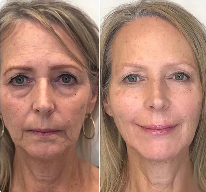 SERUM ANTIEDAD DE GINSENG ORIGINAL CON RAIZ